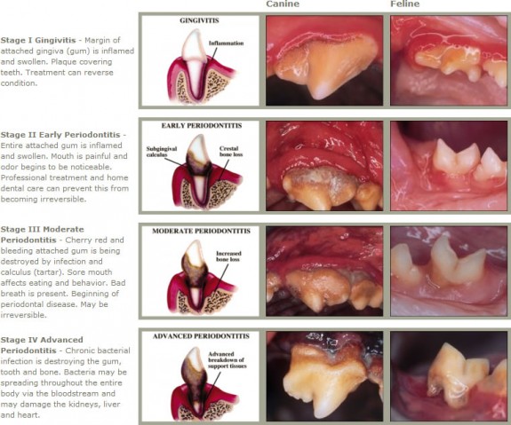 Gingivitis and Periodontal disease chart